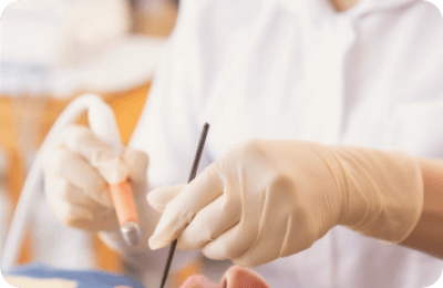 Step 05 治療開始（必要に応じて）